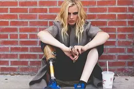 双腿截肢、白化病！这4位超模因身体缺陷更声名大噪图片