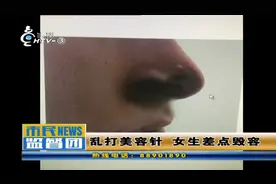20多岁女孩打针隆鼻，一针下去有点疼，过几天一看想死的心都有了视频封面
