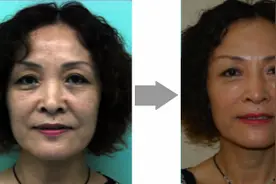 济南伊美尔海薇玻尿酸 超越原生力让肌龄新生图片