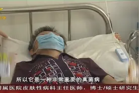 马尔尼菲篮状菌病发病率高不高？怎么预防马尔尼菲篮状菌感染？视频封面