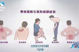发烧长包腰腿痛，好难受！什么东西在身体里作怪？视频封面