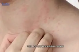 美国艾滋疫苗研究取得重大突破, 猴子注射后成功免疫, 即将大量施视频封面