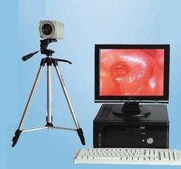 高危型仍然低危型“HPV传染”，下一步的处置是区别的！