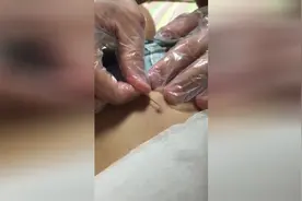 网友帮朋友挤后腰的黑头，这样优质黑头哪里找啊？看的好过瘾！图片
