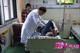 老人皮肤一碰就疼 到底啥病图片