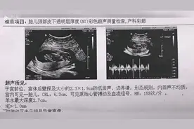 孕期6次彩超全分享双顶径股骨长胎心率，你觉得是否有规律可循视频封面