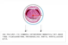崔玉涛告诉你宝宝吃奶费力，口齿不清，是不是舌系带惹的祸？图片