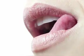 嘴唇越舔反而越干 唇部干裂时应该怎么缓解？图片