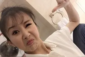 孙菲菲晒照破整容失败传闻 孙菲菲整容前后对比图片