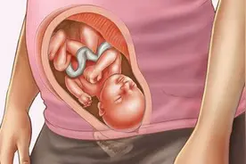 孕妈妈衣食住行有哪些需要注意的？图片