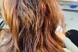 他将强力胶挤在15岁女孩的头上，女孩这样回应图片