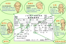 图解教孕妈妈如何看懂B超图片