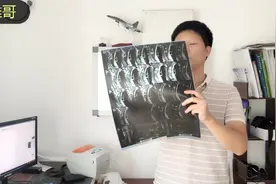 如何用手机拍清楚X、CT或MRI片？视频封面