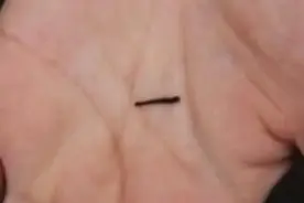 除了吸血，水蛭还做过很多事情图片