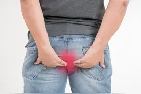 疾病防治｜“十人九痔”是真的吗？图片
