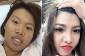 越南丑女为了嫁给富二代，去整容成为美少女，生了女儿后怎样？图片