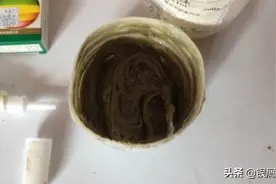 凡士林加西瓜霜——银屑病的救星？滁州36岁男子：要了我半条命图片