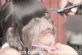 女孩身患离奇怪病，满脸毛发，疑似返祖