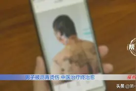 滚烫的沥青从头浇下，男子全身多处遭遇严重烧烫伤图片