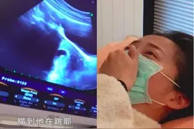赵小侨胎停后痛苦引产12小时：宝宝，再见图片