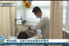 “埋线减肥”或非你想象中的那样！效果因人而异，并非人人都适合图片