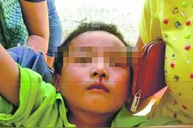 因为父母的疏忽，六岁孩子患上白血病图片