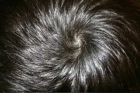 头顶有两个旋的孩子更聪明？发旋到底和什么有关，看看科学解释图片