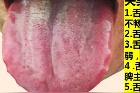 胃疼、消化不良、腹胀腹泻、慢性胃炎的7种情况图片