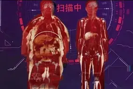 奖门人：双脚是疾病“反映区”，这些变化可能是大病来袭图片