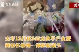 全球最小早产儿245克，被5个月精心照顾顺利从医院“毕业”图片