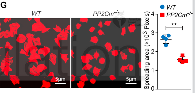 增肌不成反伤身，支链氨基酸补充剂竟然有害