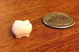 孩子退掉的乳牙，父母不要乱扔，关键时刻能救孩子一命！图片