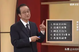 身上黑痣去不得，小心恶变有风险！图片