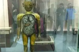 日本惊现北宋“针灸铜人”，轰动整个中医学界，专家称：这不可能图片