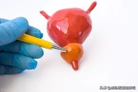探讨一个广大男性普遍关心的问题：提肛对早泄有没有作用？图片