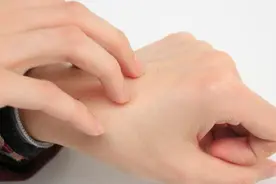为何有的人手上青筋很多，还凸起，是怎么了？图片