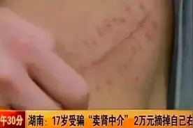 10年前卖肾买手机的小伙，如今三级伤残！人切除一个肾，危害不小图片