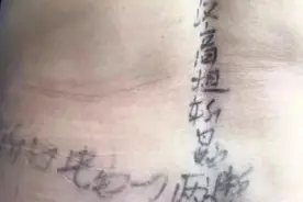 腰上长了一圈疮，邻居看到后竟然做出这么诡异地事情……图片