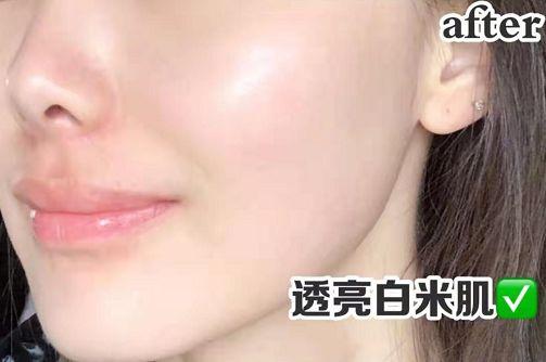 长期吃胶原蛋白有什么副作用 2026年长期吃胶原蛋白有什么副作用和危害