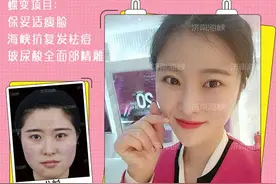 细数国产瘦脸针和进口瘦脸针的区别图片