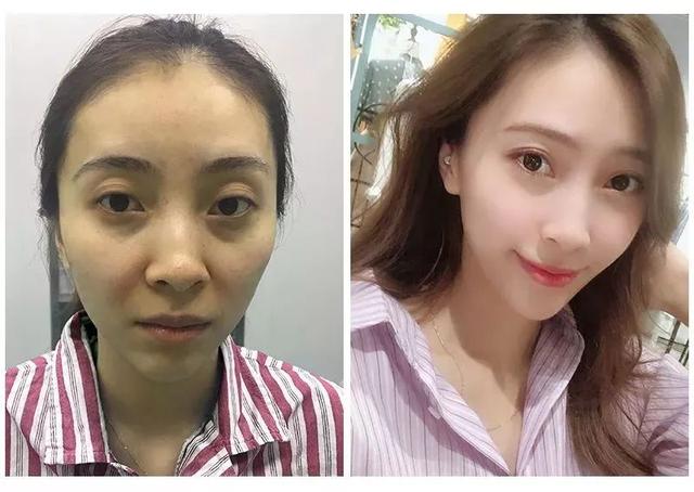 长期吃胶原蛋白有什么副作用 2026年长期吃胶原蛋白有什么副作用和危害