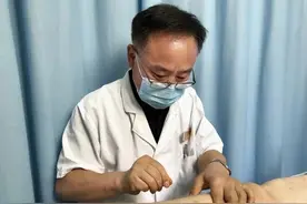 「关注前沿」大洋彼岸的“针灸”，“针”对的不仅仅是疼痛图片