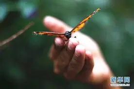 手指被门夹了一下！20岁湖南女子居然得了这个罕见的病图片