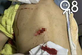 现实版农夫与蛇！杭州男子帮姐夫介绍工作，还给了3000块钱，结果却被他砍了两刀图片
