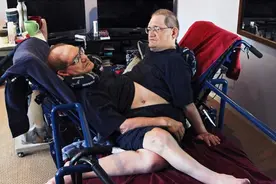 世界最长寿连体双胞胎68岁去世！两兄弟从胸骨到腹股沟相连图片