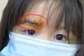 女儿餐厅乱跑意外摔伤，缝了7针店方要担责，家长：沙发有水图片