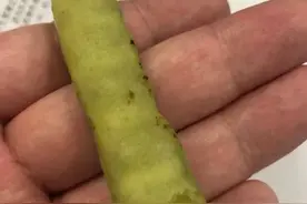 浙江有人吃了这种“豆子”，神志不清9小时，病情危急！医生：有剧毒图片
