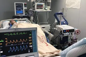 东莞这些医院有ECMO！被神化的利器背后，考量医院综合实力！图片
