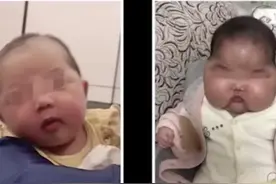 “激素”面霜再现江湖，快对你的化妆品验明正身吧图片