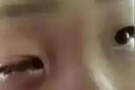20分钟孩子眼球被溶化！医生说这东西每家都有，家长一定要高度警惕图片